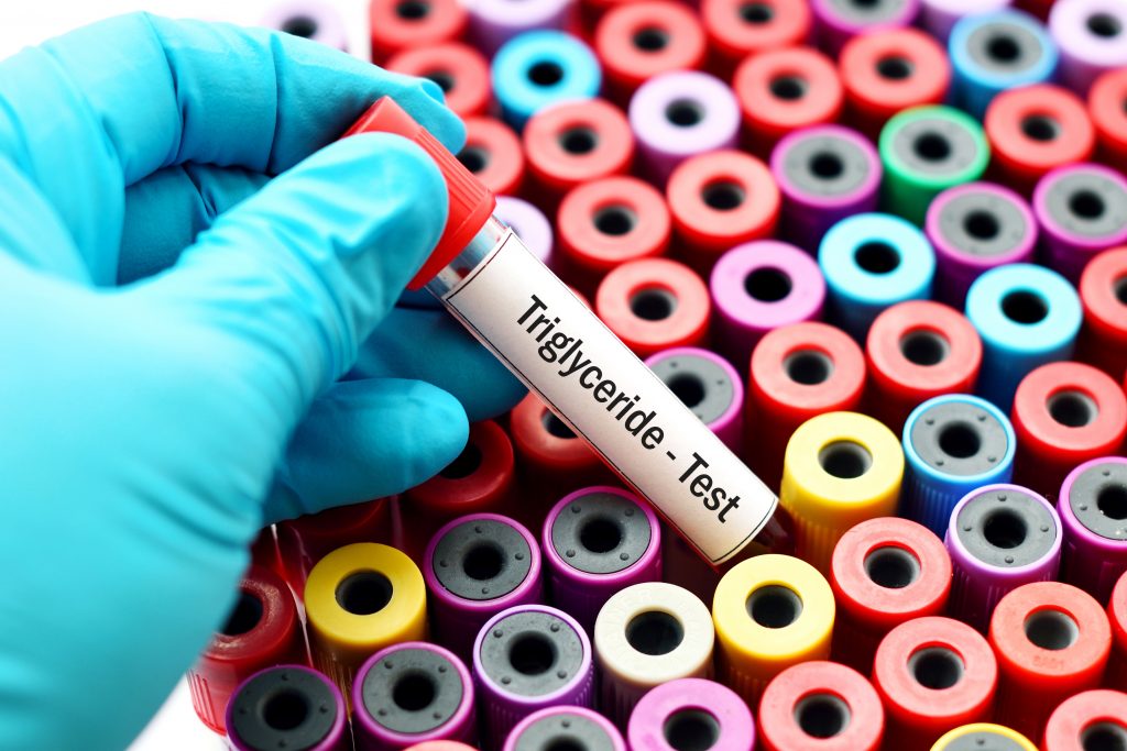 Triglyceride tests