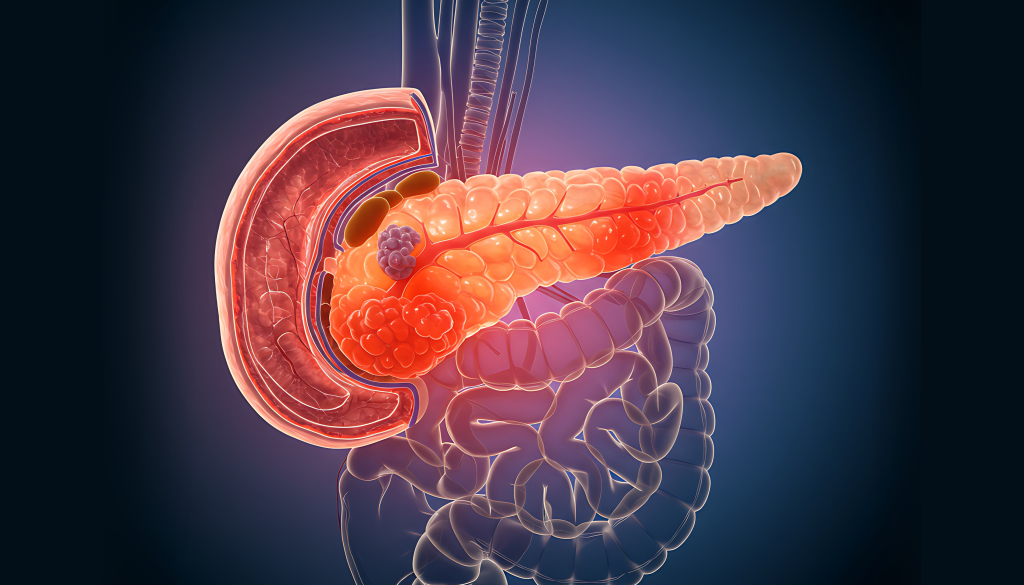 inflamed pancreas
