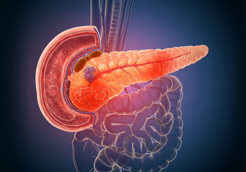 inflamed pancreas
